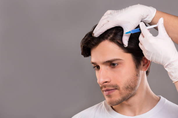 890+ Prp For Hair Loss Stock Photos, Pictures & Royalty-Free Images - iStock