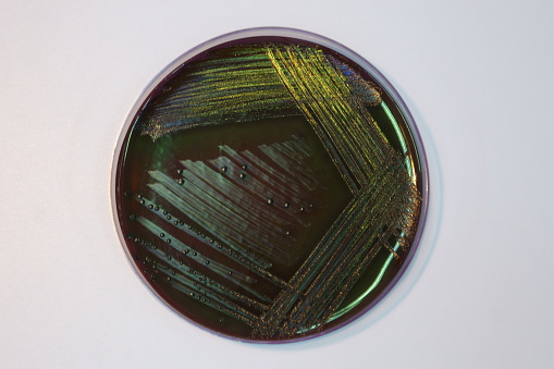 Escherichia coli en placa de agar azul de eosina metileno : Concepto de bacteriología diagnóstica photo