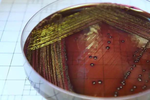 Photo of Escherichia coli on Eosin Methylene Blue Agar Plate : Diagnostic Bacteriology Concept