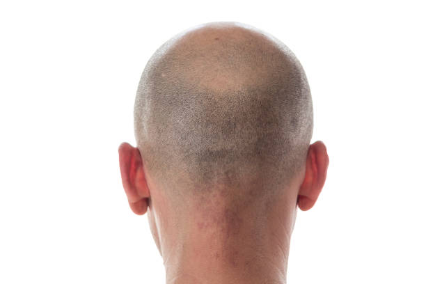 Bald man head on the back Bald man back view, head with hair loss skinhead haircut stock pictures, royalty-free photos & images