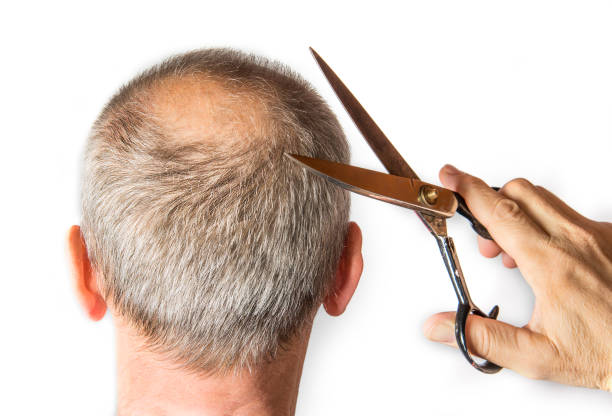 bald man with comb. hair loss concept - shaved head imagens e fotografias de stock