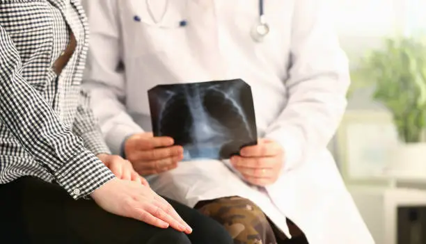 Photo of Doctor holds patient x-ray and reports bad news