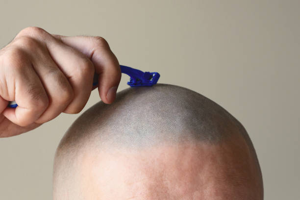 bald man shaves his head razor arm and bald head close up. self shave"n shaving stock pictures, royalty-free photos & images