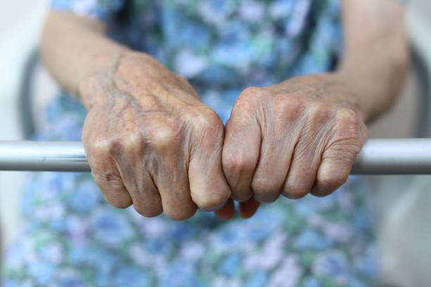 istock Old lady's hand. Elderly lady is waiting for help. Senior lady experiencing bad service and conditions in retirement nursing home.Elderly concept. Aging concept 1164672641
