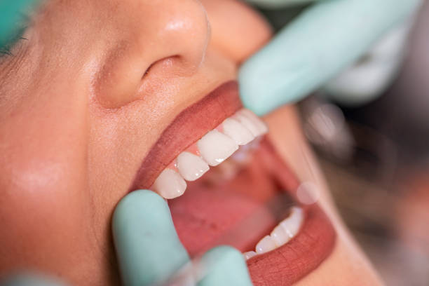 istock Examination of the teeth 1164710641