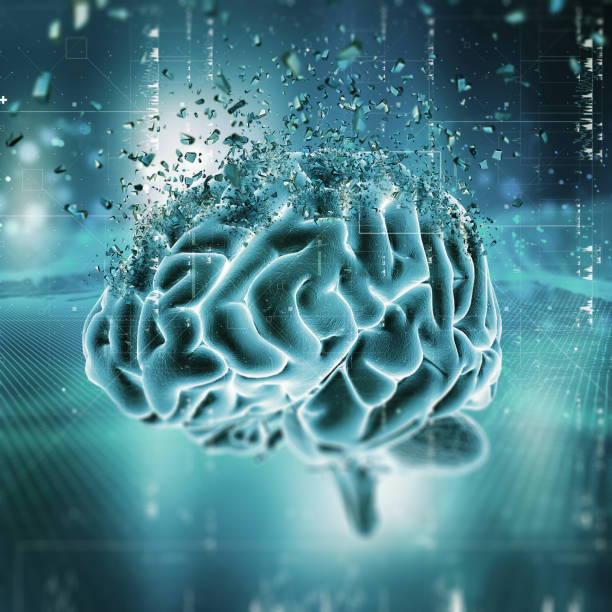 istock 3D medical image showing a brain shattering 1164775824