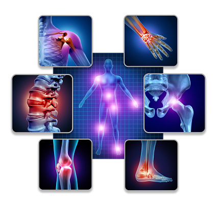 Human body joint pain concept as skeleton and muscle anatomy of the body with a group of sore joints as a painful injury or arthritis illness symbol for health care and medical symptoms with 3D illustration elements.