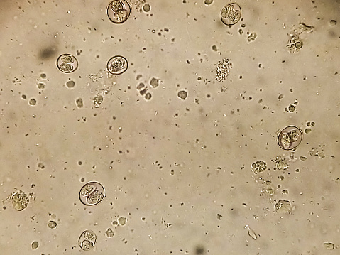 Isospora spp. oocysts from cat feces under the microscope