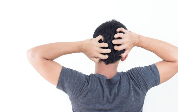 istock Young man suffering from itching her head, Itching scalp. 1164932661