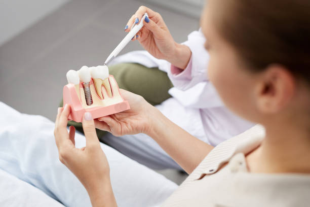 Explaining Tooth Implantation High angle view of unrecognizable young woman holding tooth model during consultation in dentists office, copy space dental equipment hand stock pictures, royalty-free photos & images