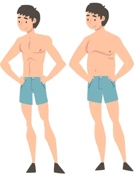 Vector illustration of Young Man in Underwear Before and After Weight Loss, Male Body Changing Through Healthy Nutrition or Sports Vector Illustration