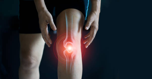 膝の痛みに苦しむ高齢女性。腱の問題と暗い背景の関節の炎症. - 骨 ストックフォト��と画像
