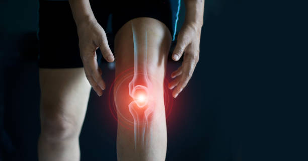 Elderly woman suffering from pain in knee. Tendon problems and Joint inflammation on dark background. Elderly woman suffering from pain in knee. Tendon problems and Joint inflammation on dark background. osteoarthritis in knees stock pictures, royalty-free photos & images