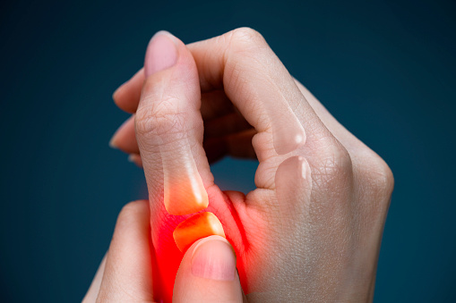 Thumb Pain - Medical X-ray