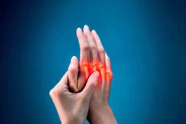 指の痛み - 医療x線 - 関節炎 ストックフォトと画像