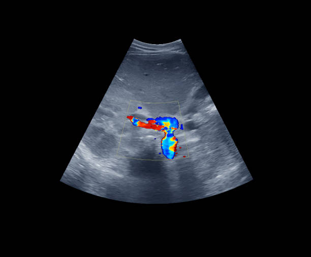 ultrasound upper abdomen showing flow in common bile duct  after use color doppler. clipping path. - human upper body xray imagens e fotografias de stock