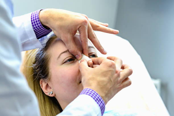 Recovery process after surgery The doctor's hands in blue plastic gloves are used Rena therm bandage Hartman on the nose of the patient nose stock pictures, royalty-free photos & images