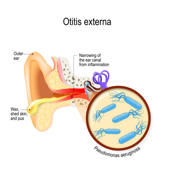 ilustrações de stock, clip art, desenhos animados e ícones de swimmer's ear. otitis externa - eustachian tube