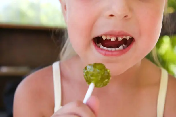 Child eats candy. Girl has caries on teeth.