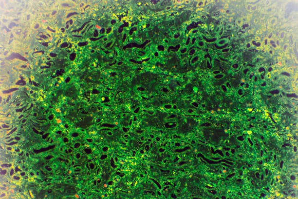 istock Kidney proximal tubule epithelial cloudy SWELLING under different area in light microscopyKidney 1165408411