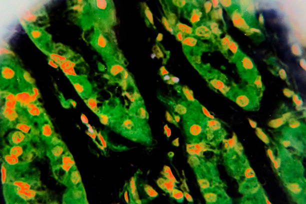 istock Gastric mucosa intestinal metaplasia under microscopy 1165408932