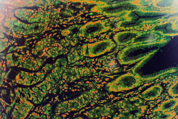 istock Gastric mucosa intestinal metaplasia under microscopy 1165408945