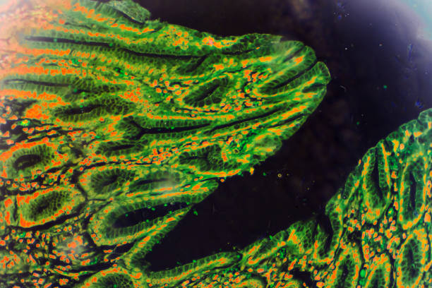 istock Gastric mucosa intestinal metaplasia under microscopy 1165408952