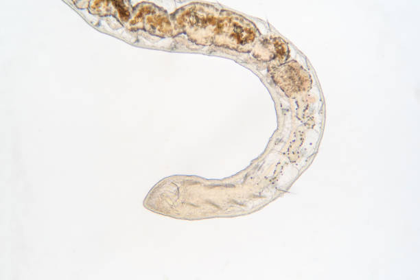 istock Tubifex worm under the microscope view for education. 1165424200