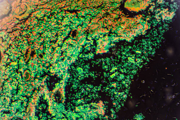 Hypertension disease renal different area under microscopy, this is art treated normal light microscopy image,for original image check my other files