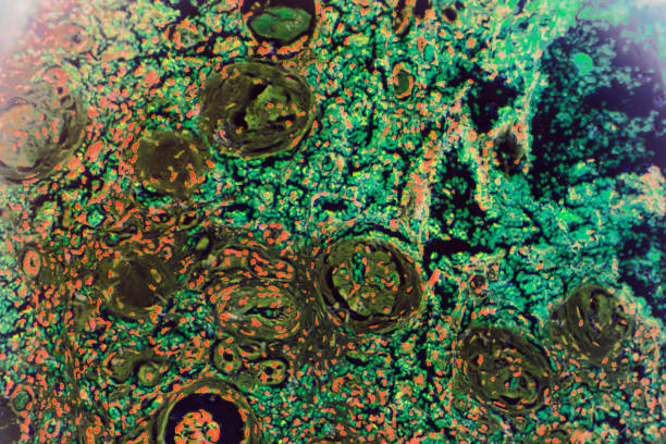 istock Hypertension disease renal different area under microscopy 1165531618