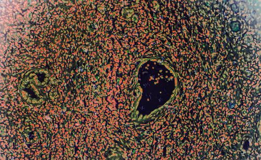 Hypertension disease renal different area under microscopy, this is art treated normal light microscopy image,for original image check my other files