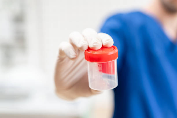 le docteur dans l'uniforme bleu et les gants de latex retient un récipient en plastique vide pour prendre des échantillons d'urine, fond léger. concept médical. - medical sample photos et images de collection