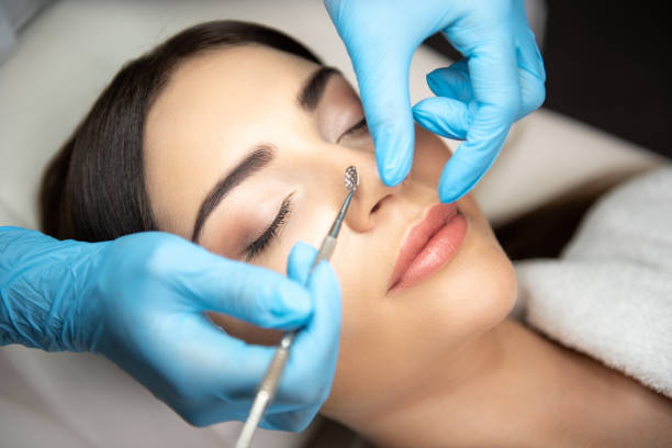 istock Cosmetologist cleaning lady face with blackhead remover 1165760020