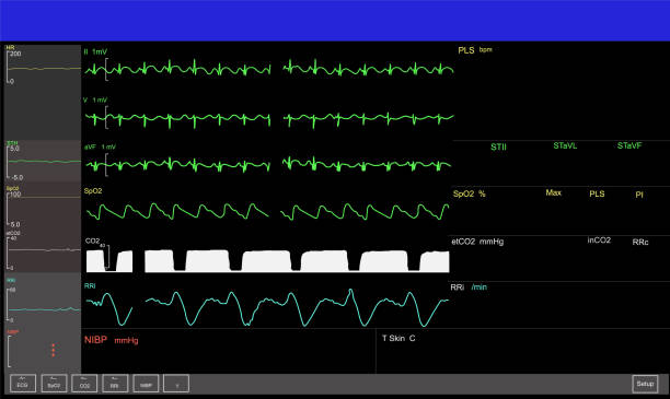 istock Monitoring display of patient vital signs 1166002114