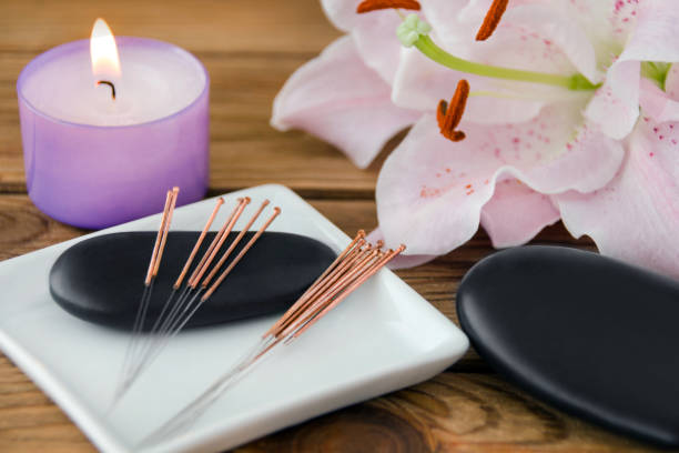Acupuncture and Hot Stone Massage Acupuncture and Hot Stone Massage background acupuncture photos stock pictures, royalty-free photos & images