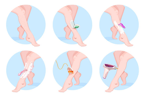 ilustraciones, imágenes clip art, dibujos animados e iconos de stock de depilación y cosmetología, conjunto de procedimientos de salón de belleza. métodos de depilación láser y cera, ilustración de dibujos animados vectoriales - waxing