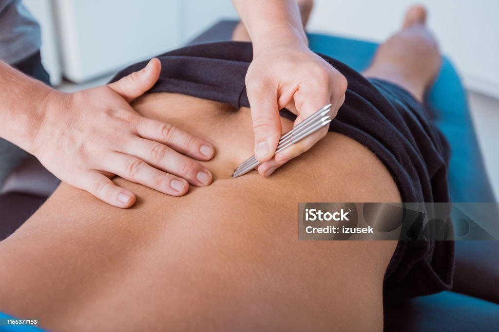 Therapist giving back massage to a man with tools Close-up of a physical therapist giving back massage to a man using tools. Adult Stock Photo