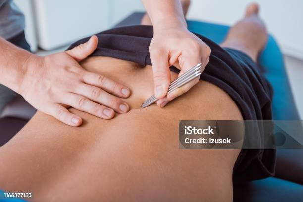 Therapist Giving Back Massage To A Man With Tools Stock Photo - Download Image Now - Adult, Adults Only, Alternative Therapy