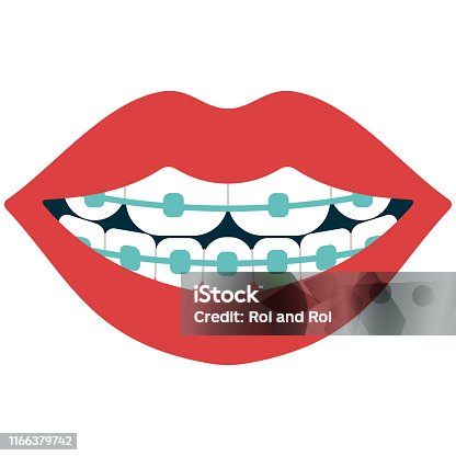 2,344 Orthodontic Braces Cartoons Illustrations & Clip Art - iStock