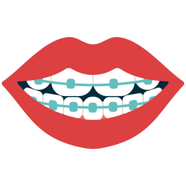Dental braces vector cartoon illustration isolated on a white background. Dental braces vector cartoon illustration. orthodontist stock illustrations