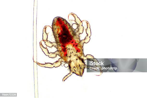 Ønske kæmpe stor snyde Head Lousepediculus Capitis Mikroskop Bild Rött Blod Inuti Sin Kropp Och  Hårstrå-foton och fler bilder på Bita - iStock
