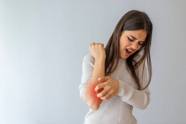 istock Young woman scratching arm from having itching on white background 1166495231