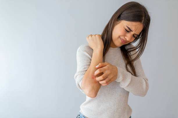 Women scratch the itch with hand Women scratch the itch with hand , Concept with Healthcare And Medicine. Woman scratching arm on grey background. Allergy symptoms. Woman scratching her arm. photo psoriasis stock pictures, royalty-free photos & images