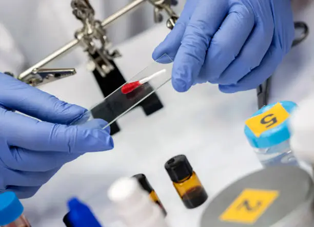 Photo of Scientist Police hold swab microscope support with blood traces, conceptual image