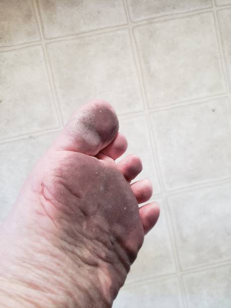 istock Dirty bottom of a human foot 1166680246