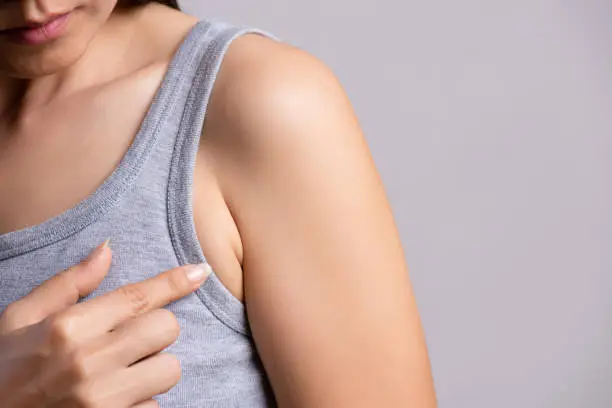 Photo of Close up woman pointing her skin underarm. problem armpit fat skin concept.