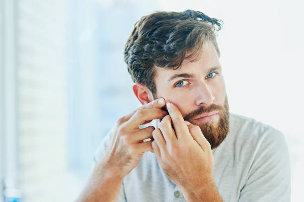 istock This is the fastest way to get rid of them! 1166807161