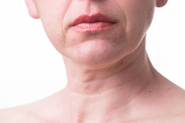 Furrowed lips of a mature woman.Signs of aging skin after 40 Furrowed lips of a mature woman.Signs of aging skin after 40 neck stock pictures, royalty-free photos & images