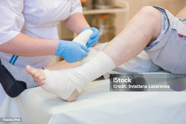 Nurse Bandages The Leg Fracture Of Human Lower Limbs Treatment Of Broken Bones Impose A Gypsum Patient Surgical Department The Doctors Hands Tighten The Bandage On His Leg Stock Photo - Download Image Now