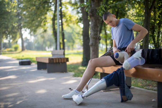 Disabled young man changing prosthetic leg type in a public park.